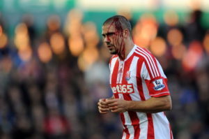 Stoke City v Queens Park Rangers – Premier League